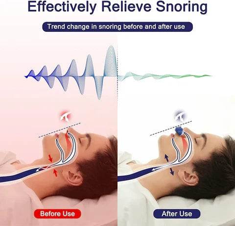 Compact Nasal Device – USB-Rechargeable with Practical Travel Box 4